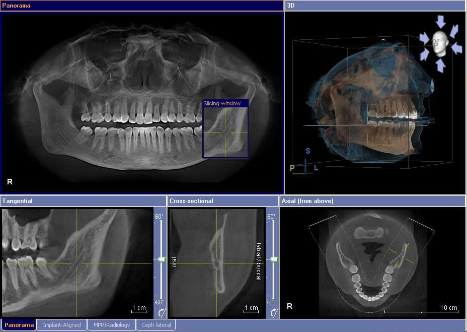 3D Imaging